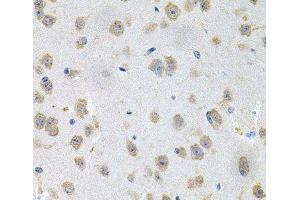 Immunohistochemistry of paraffin-embedded Mouse brain using GNE Polyclonal Antibody at dilution of 1:100 (40x lens). (GNE anticorps)