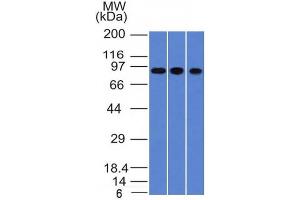 Western Blot of A549, HepG2 & HCT116 cell lysates with Villin Monoclonal Antibody (VIL1/1314). (Villin 1 anticorps  (AA 179-311))