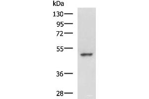 Western blot analysis of Hela cell lysate using MYCN Polyclonal Antibody at dilution of 1:800