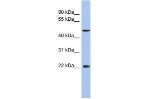 WB Suggested Anti-ANKH Antibody Titration:  0. (ANKH anticorps  (N-Term))