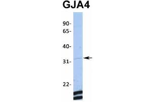 Host:  Rabbit  Target Name:  GJA4  Sample Type:  MCF7  Antibody Dilution:  1. (GJA4 anticorps  (Middle Region))