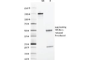 SDS-PAGE Analysis Purified Alpha-1-Antitrypsin Mouse Monoclonal Antibody (AAT/1378). (SERPINA1 anticorps)