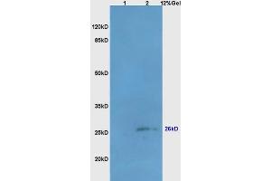 Lane 1: mouse liver lysates Lane 2: mouse brain lysates probed with Anti Bcl-10/CLAP/CIPER Polyclonal Antibody, Unconjugated (ABIN749828) at 1:200 in 4 °C. (BCL10 anticorps  (AA 81-180))