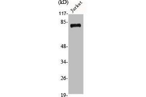 Western Blot analysis of Jurkat cells using Adducin β Polyclonal Antibody (ADD2 anticorps  (Internal Region))