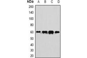 Western blot analysis of TUG expression in SW480 (A), A549 (B), mouse liver (C), mouse testis (D) whole cell lysates.