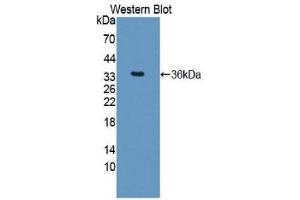 WB of Protein Standard: different control antibodies against Highly purified E. (ARG Kit ELISA)