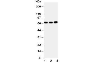 Western blot testing of GBP1 antibody and Lane 1:  U87;  2: HeLa;  3: MCF-7 cell lysate (GBP1 anticorps  (AA 566-589))