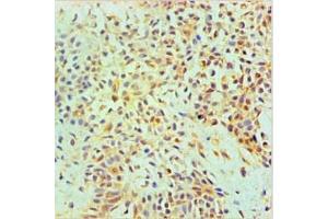 Immunohistochemical of paraffin-embedded Human Breast tissue using ABIN7144345 at dilution of 1:200. (Annexin A2 anticorps)