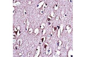 LMO2 antibody immunohistochemistry analysis in formalin fixed and paraffin embedded human brain tissue.