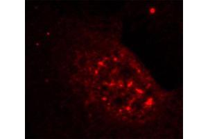 Immunofluorescence staining of methanol-fixed Hela cells showing nuclear dot staining using Phospho-AKT1-T308 antibody. (AKT1 anticorps  (pThr308))