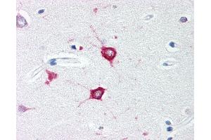 Anti-TOLLIP antibody IHC of human brain, cortex. (TOLLIP anticorps  (C-Term))