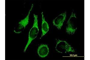 Immunofluorescence of purified MaxPab antibody to HADH2 on HeLa cell. (HSD17B10 anticorps  (AA 1-261))