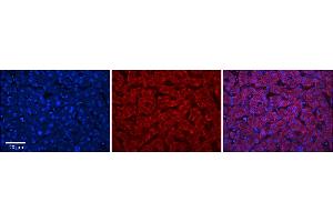 Rabbit Anti-ABHD14A Antibody  Catalog Number: ARP67926_P050 Formalin Fixed Paraffin Embedded Tissue: Human Adult Liver  Observed Staining: Cytoplasm in hepatocytes, strong signal, wide tissue distribution Primary Antibody Concentration: 1:100 Secondary Antibody: Donkey anti-Rabbit-Cy3 Secondary Antibody Concentration: 1:200 Magnification: 20X Exposure Time: 0.