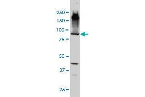 EML1 monoclonal antibody (M01A), clone 5G3 Western Blot analysis of EML1 expression in HepG2 . (EML1 anticorps  (AA 1-99))
