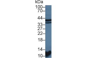 Western blot analysis of Rat Kidney lysate, using Rat STAP1 Antibody (1 µg/ml) and HRP-conjugated Goat Anti-Rabbit antibody ( (STAP1 anticorps  (AA 1-297))