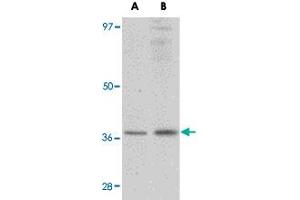 Western blot analysis of RSPO1 in rat spleen tissue lysate with RSPO1 polyclonal antibody  at (A) 1 and (B) 2 ug/mL . (RSPO1 anticorps  (N-Term))