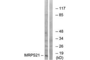 Western blot analysis of extracts from COS cells, using MRPS21 Antibody.