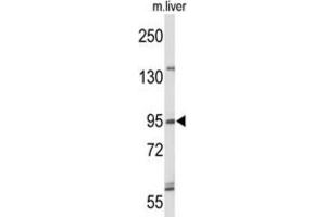 Western Blotting (WB) image for anti-Gen Endonuclease Homolog 1 (GEN1) antibody (ABIN3004202) (GEN1 anticorps)