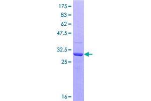 Image no. 1 for Twist Homolog 1 (Drosophila) (TWIST1) (AA 106-174) protein (GST tag) (ABIN1324202)