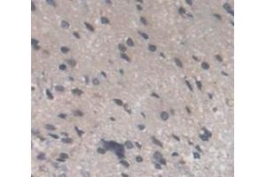 Used in DAB staining on fromalin fixed paraffin- embedded Kidney tissue