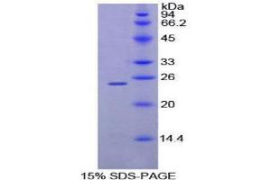SDS-PAGE (SDS) image for Myeloproliferative Leukemia Virus Oncogene (MPL) (AA 66-260) protein (His tag) (ABIN1879576)