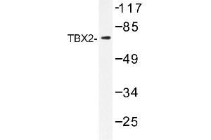 Image no. 1 for anti-T-Box 2 (TBX2) antibody (ABIN272220) (TBX2 anticorps)