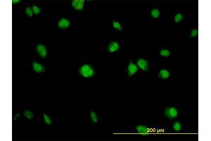 Immunofluorescence of monoclonal antibody to AKT1 on HeLa cell.