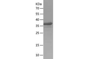Western Blotting (WB) image for Mitochondrial Antiviral Signaling Protein (MAVS) (AA 379-516) protein (His-IF2DI Tag) (ABIN7123974)