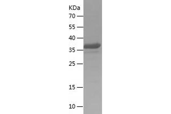 MAVS Protein (AA 379-516) (His-IF2DI Tag)