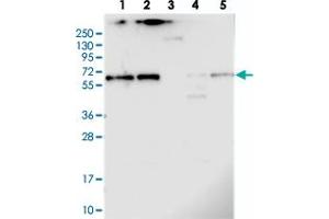 Western blot analysis of Lane 1: RT-4, Lane 2: U-251 MG, Lane 3: Human Plasma, Lane 4: Liver, Lane 5: Tonsil with CCDC125 polyclonal antibody . (CCDC125 anticorps)