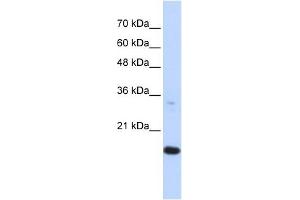 GABARAPL1 antibody used at 1 ug/ml to detect target protein. (GABARAPL1 anticorps)