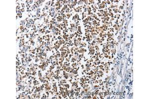 Immunohistochemistry of Human tonsil using MCM6 Polyclonal Antibody at dilution of 1:45 (MCM6 anticorps)