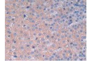 IHC-P analysis of Rat Adrenal Gland Tissue, with DAB staining. (IL12A anticorps  (AA 23-215))