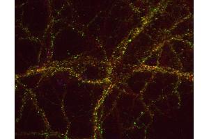 Indirect immunostaining of PFA fixed rat hippocampus neurons with anti-DAP 1 (dilution 1 : 500; green) and mouse anti-synapsin 1 (cat.