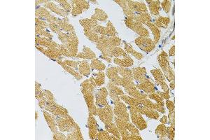 Immunohistochemistry of paraffin-embedded rat heart using SYK Antibody (ABIN5971150) at dilution of 1/100 (40x lens). (SYK anticorps)