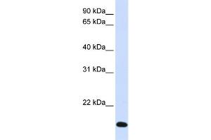 WB Suggested Anti-RNF185 Antibody Titration:  0. (RNF185 anticorps  (Middle Region))