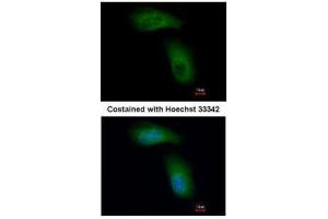ICC/IF Image Immunofluorescence analysis of methanol-fixed A549, using TRIM36, antibody at 1:500 dilution.