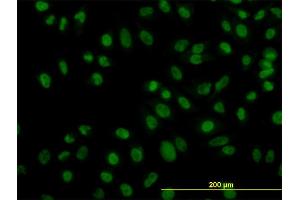 Immunofluorescence of monoclonal antibody to ZNF143 on HeLa cell. (ZNF143 anticorps  (AA 1-626))