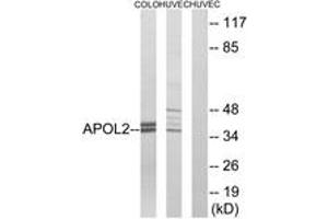 Western blot analysis of extracts from HuvEc/COLO cells, using APOL2 Antibody.