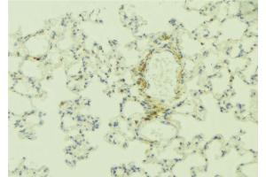 ABIN6268893 at 1/100 staining Human lung tissue by IHC-P. (Integrin beta 4 anticorps  (C-Term))