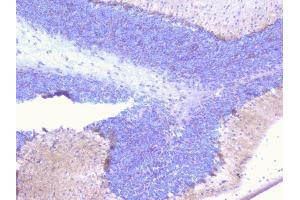 IHC analysis of PCDH15 using anti-PCDH15 antibody (ABIN6719362). (PCDH15 anticorps)