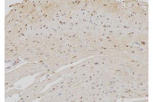 ABIN6259132 and ABIN6273372 at 1/100 staining Rat heart tissue by IHC-P. (NOC4L anticorps  (Internal Region))