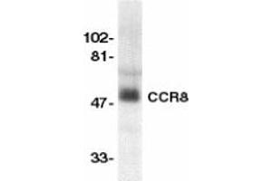 Image no. 1 for anti-Chemokine (C-C Motif) Receptor 8 (CCR8) (AA 183-201) antibody (ABIN201969) (CCR8 anticorps  (AA 183-201))