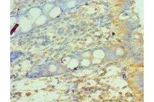 Immunohistochemistry of paraffin-embedded human colon tissue using ABIN7159067 at dilution of 1:100 (MMP14 anticorps  (AA 260-540))