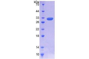 SDS-PAGE analysis of Rat IL7R Protein.