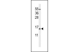 Western blot analysis of KCE1L Antibody (Center) (ABIN653619 and ABIN2842976) in NCI- cell line lysates (35 μg/lane). (KCNE1-Like anticorps  (AA 67-96))
