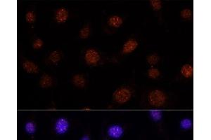 Immunofluorescence analysis of L-929 cells using GLI2 Polyclonal Antibody at dilution of 1:100. (GLI2 anticorps)