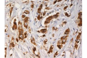 Immunohistochemistry staining of AGR3 with mouse monoclonal AGR3. (AGR3 anticorps)