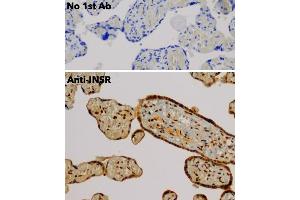 Immunohistochemistry (IHC) image for anti-Insulin Receptor (INSR) (C-Term) antibody (ABIN6254165) (Insulin Receptor anticorps  (C-Term))