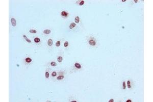 Immunocytochemistry analysis of ABIN7127267 diluted at 1:100 and staining in HepG2 cells performed on a Leica BondTM system. (Recombinant Histone H3.1 anticorps  (H3K56ac))
